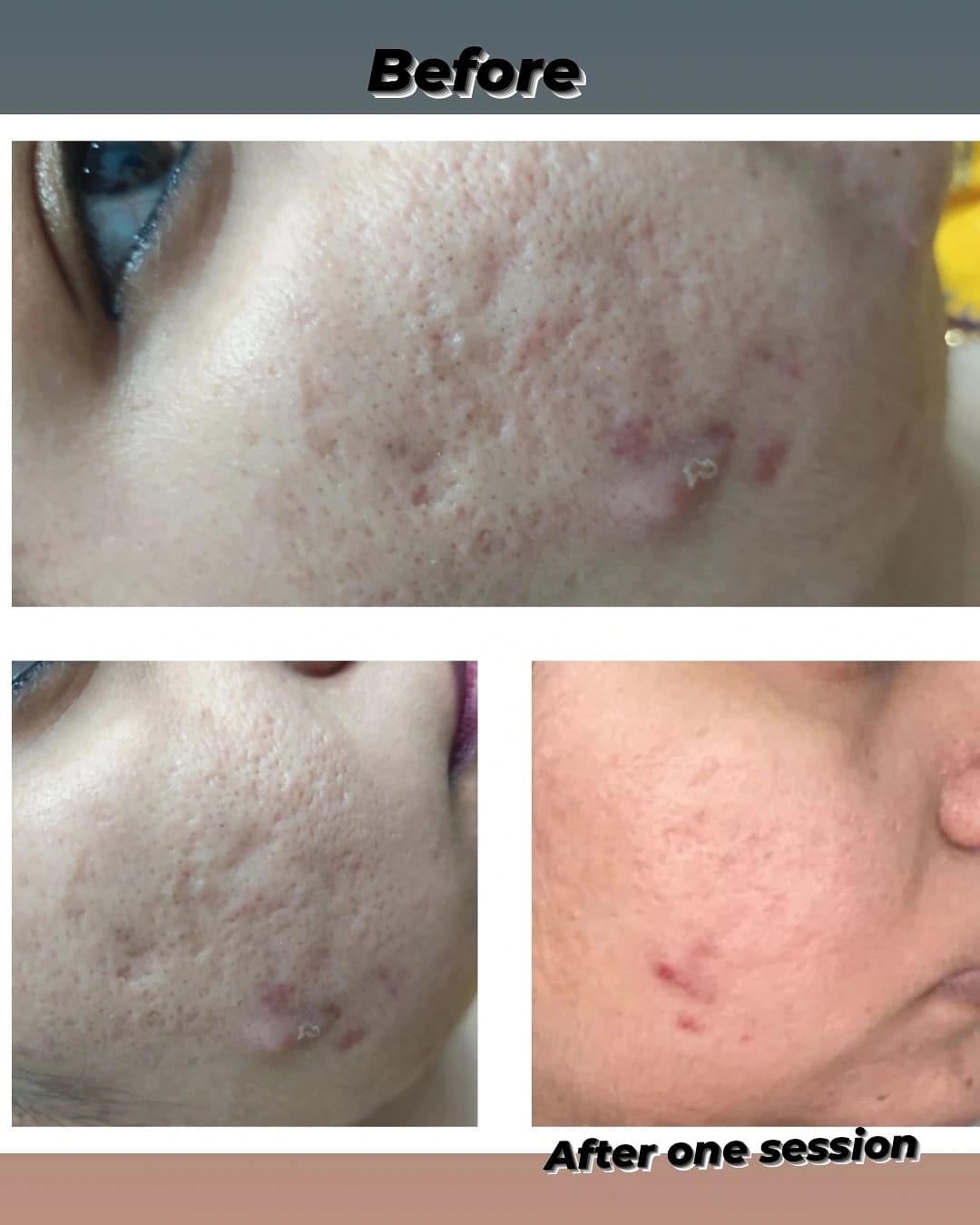 Before After Cosmetic Treatment